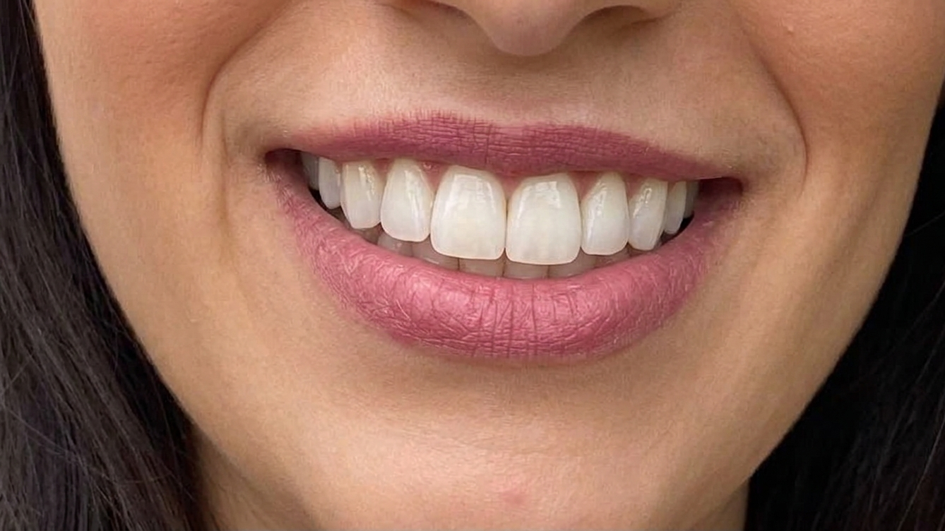 Cosmetic Dentistry Treatment